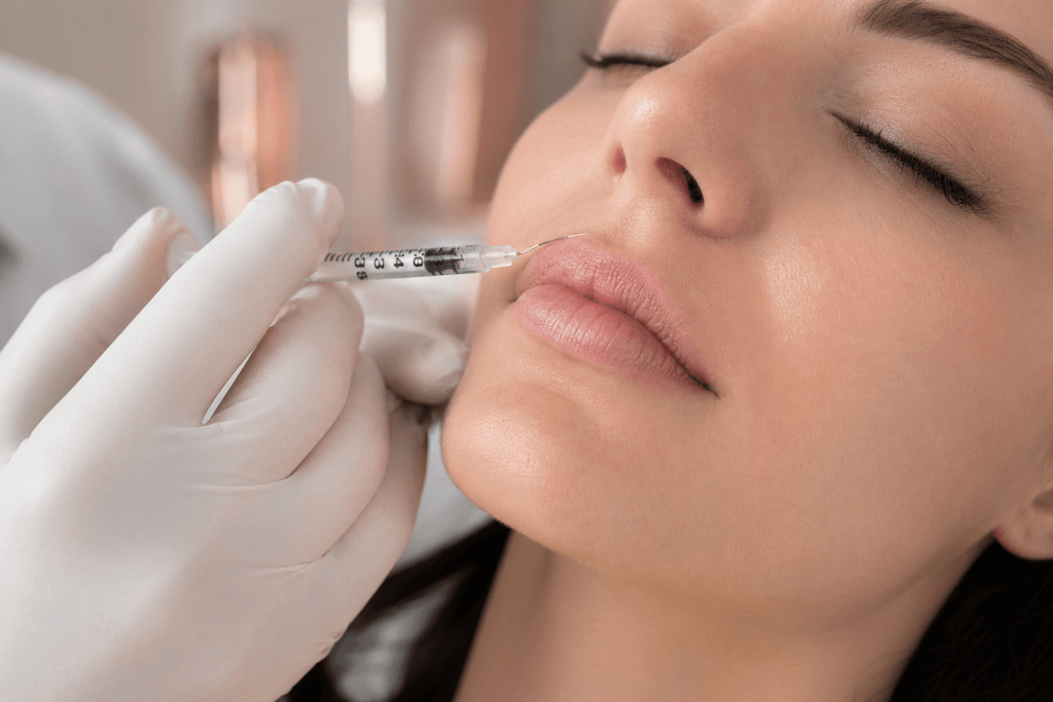 Botox (Lipflip) in Bünde